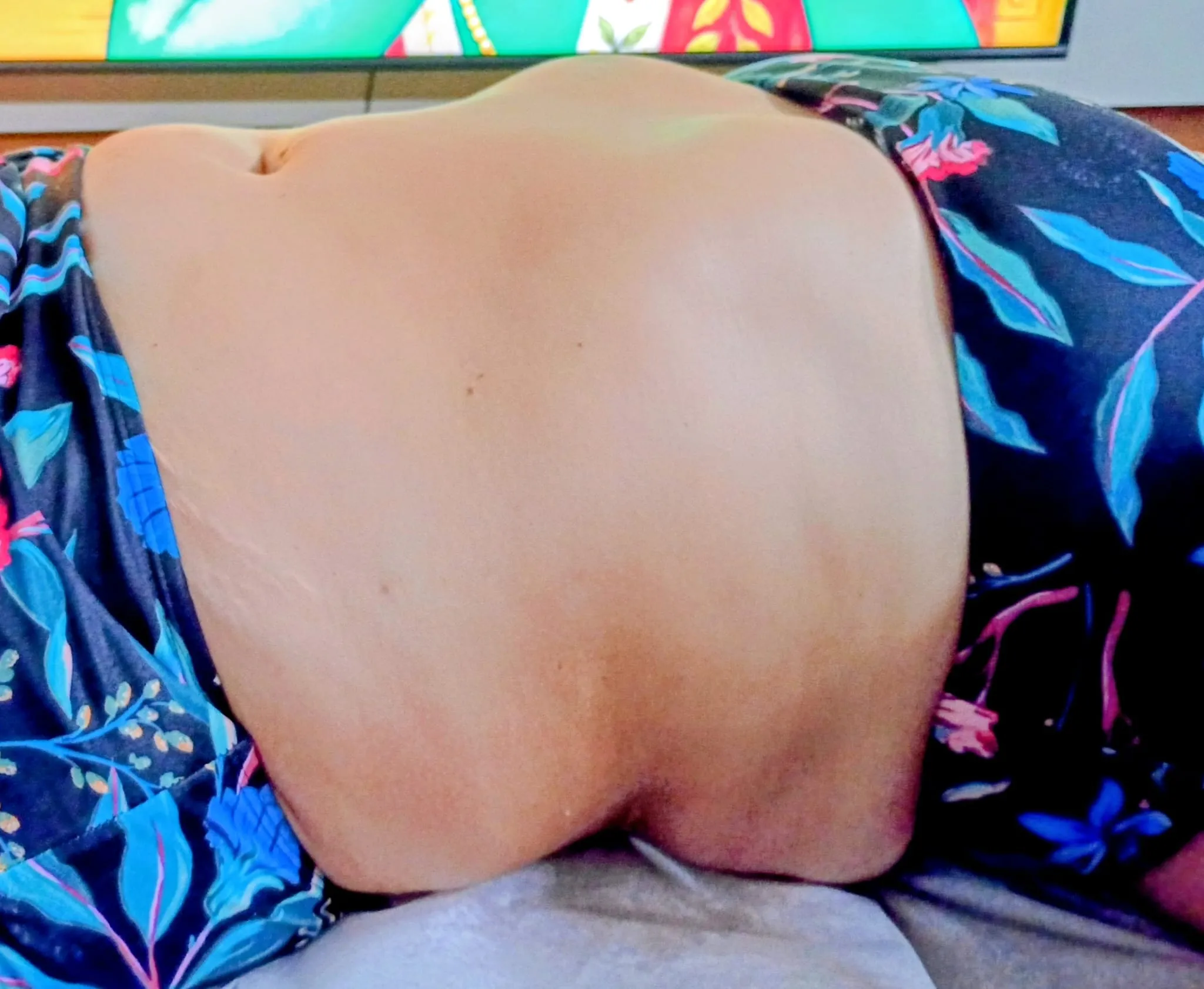Después de sesión de cavitación, maderoterapia y cupping en Casa Lienzo, Las Piedras